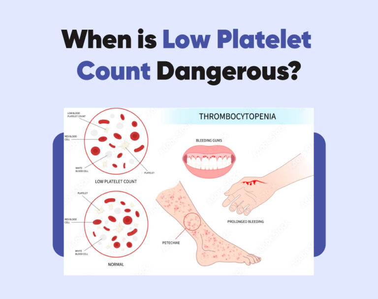 When is Low Platelet Count Dangerous?