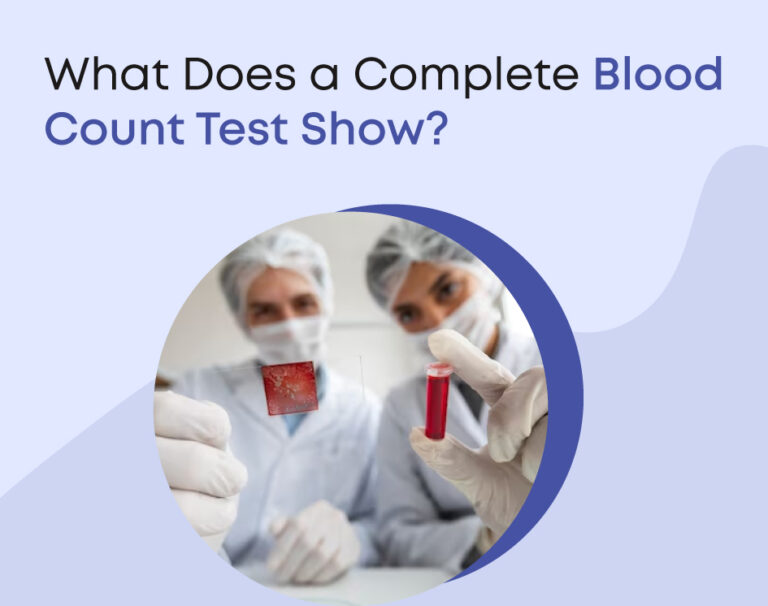 What Does a Complete Blood Count Test Show?