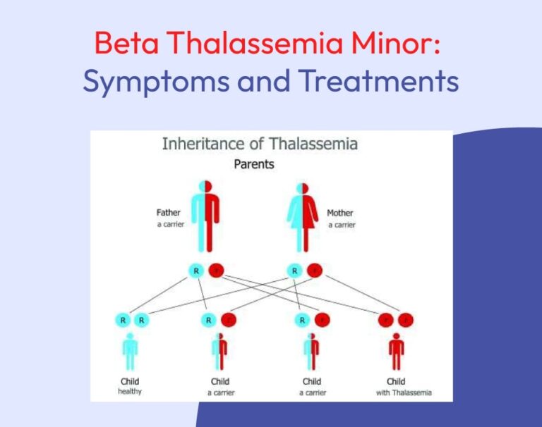 Beta Thalassemia Minor: Symptoms and Treatments