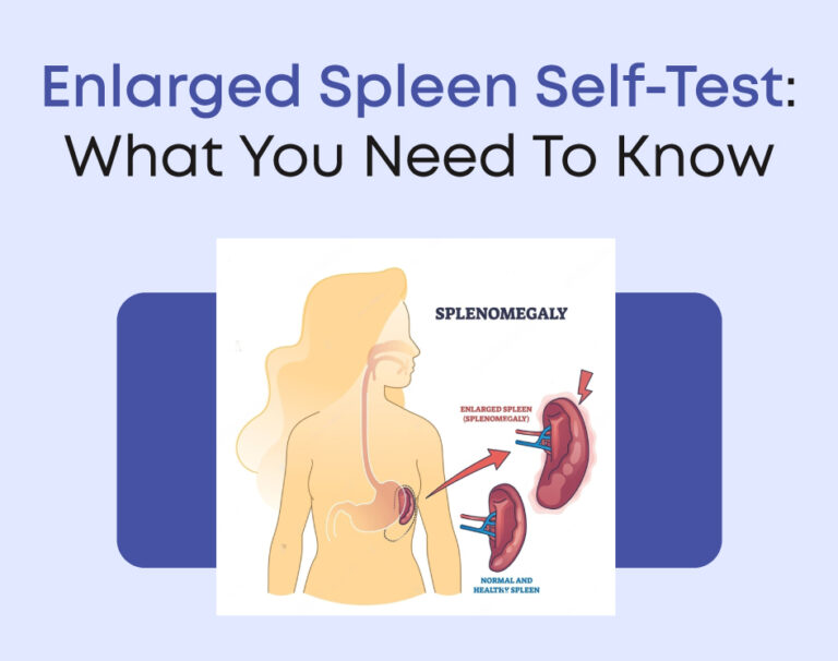 Enlarged Spleen Self-Test: What You Need To Know