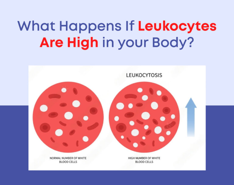 What Happens If Leukocytes Are High in your Body?