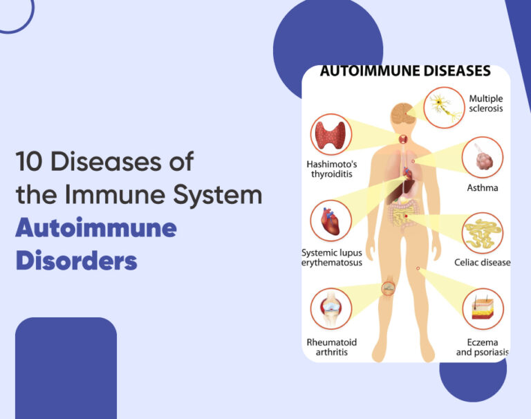 10 Diseases of the Immune System | Autoimmune Disorders