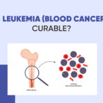 Is Leukemia (Blood Cancer) Curable?