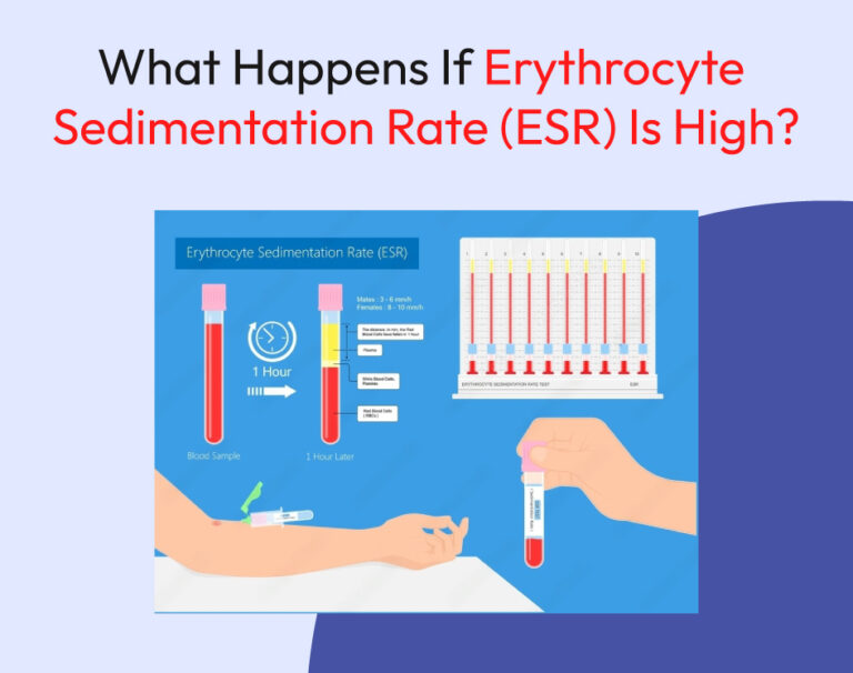 What Happens If Erythrocyte Sedimentation Rate (ESR) Is High?