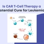 Is CAR T-Cell Therapy a Potential Cure for Leukemia?