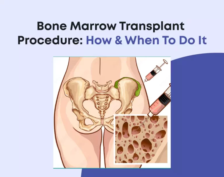 Bone Marrow Transplant Procedure: How & When To Do It