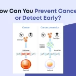 How Can You Prevent Cancer or Detect Early?
