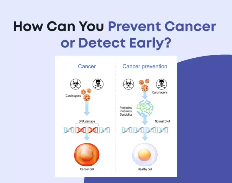 How Can You Prevent Cancer or Detect Early?