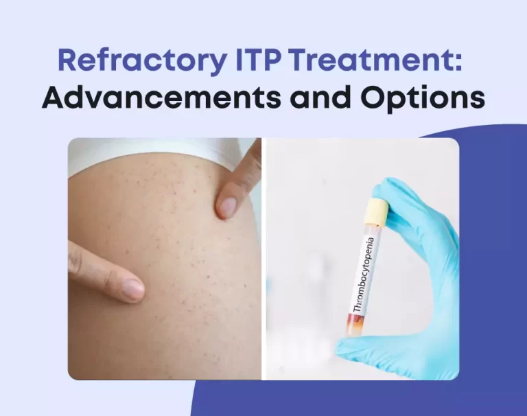 Refractory ITP Treatment: Advancements and Options