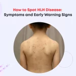 How to Spot HLH Disease: Symptoms and Early Warning Signs