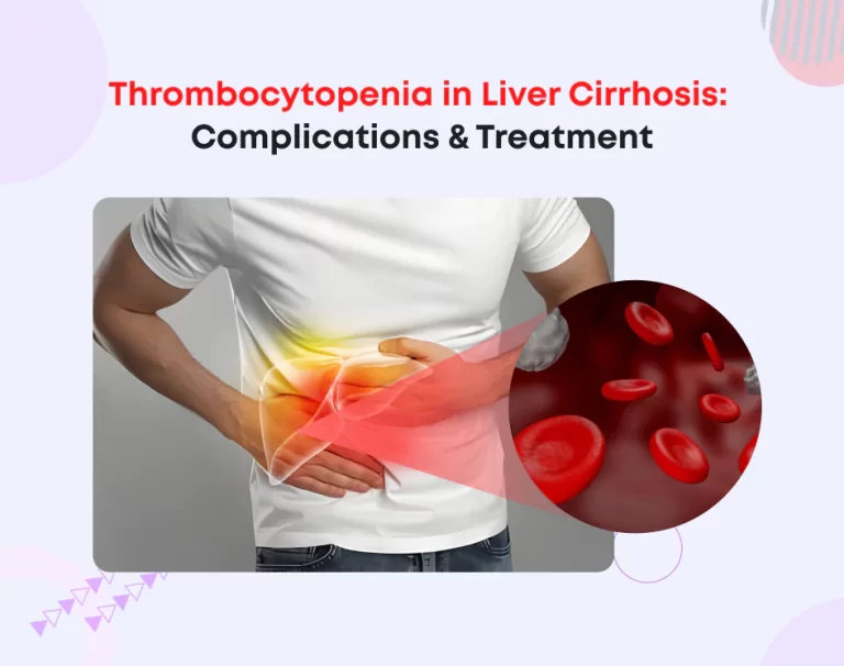 Thrombocytopenia in Liver Cirrhosis: Complications & Treatment