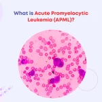 What is Acute Promyelocytic Leukemia (APML)?