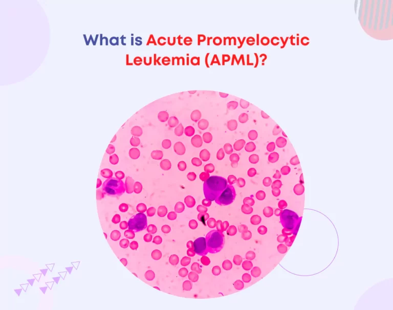 What is Acute Promyelocytic Leukemia (APML)?