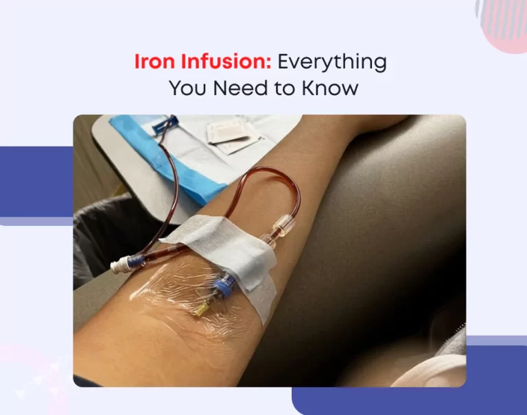 Iron Infusion: Everything You Need to Know