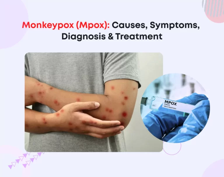 Monkeypox (Mpox): Causes, Symptoms, Diagnosis & Treatment