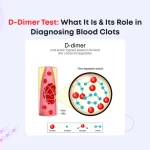 D-Dimer Test: What It Is & Its Role in Diagnosing Blood Clots