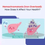 Hemochromatosis (Iron Overload)