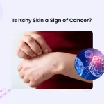 Is Itchy Skin a Sign of Cancer?