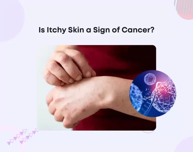 Is Itchy Skin a Sign of Cancer?