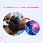 Can Tattoos Cause Lymphoma?