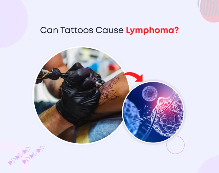 Can Tattoos Cause Lymphoma?