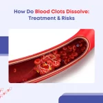 How Do Blood Clots Dissolve: Treatment & Risks