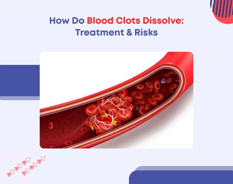 How Do Blood Clots Dissolve: Treatment & Risks