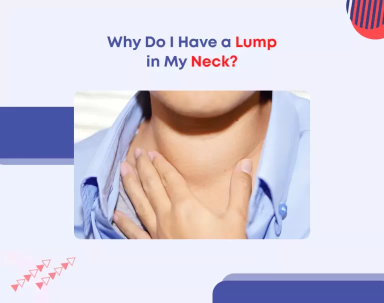 Why Do I Have a Lump in My Neck?