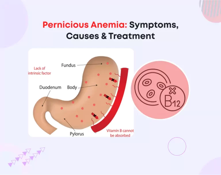 Pernicious Anemia: Symptoms, Causes & Treatment